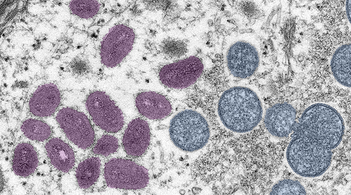 an illustration of the monkeypox virus